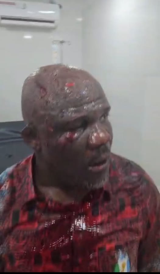 Chaos Erupts at Delta APC Stakeholders’ Meeting, Governor Oborevwori’s Aide Reportedly Attacked